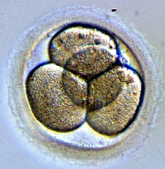 一个胚胎。学分：Wikimedia Commons